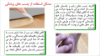 图片 جدا کننده چسب پزشکی