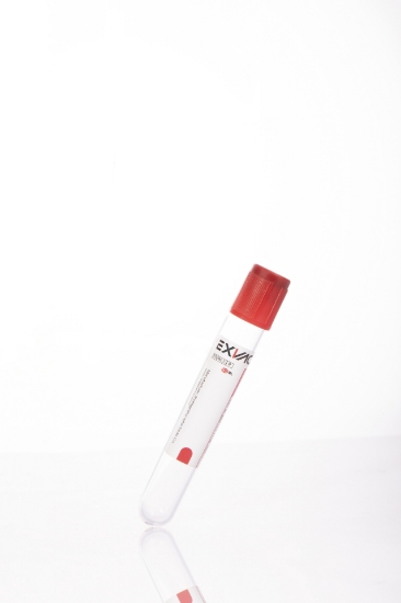صورة لوله خونگیری خلاء 9ml (Clot activator)